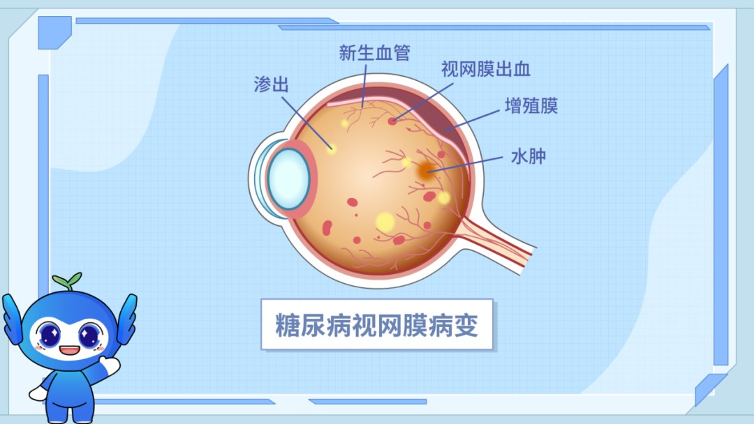 图片.png 图片.png