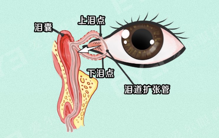 图片.png 图片.png