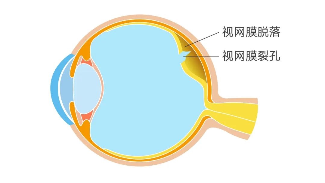 图片.png 图片.png