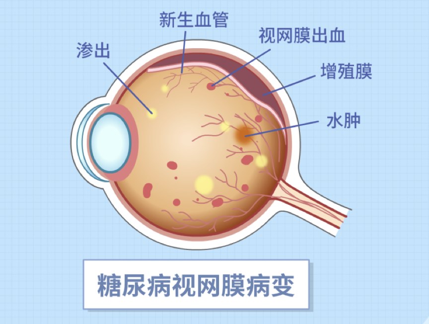 图片.png 图片.png