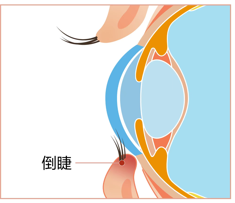 图片.png 图片.png